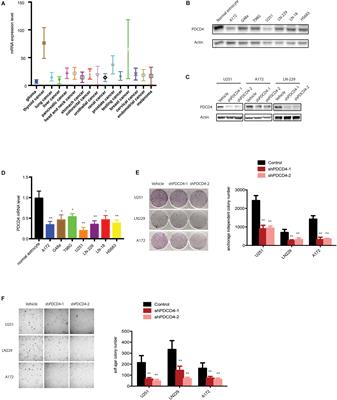 Down-Regulation of PDCD4 Promotes Proliferation, Angiogenesis and Tumorigenesis in Glioma Cells